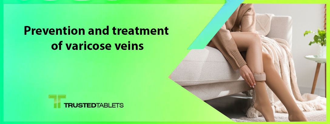 Prevention and Treatment of Varicose Veins