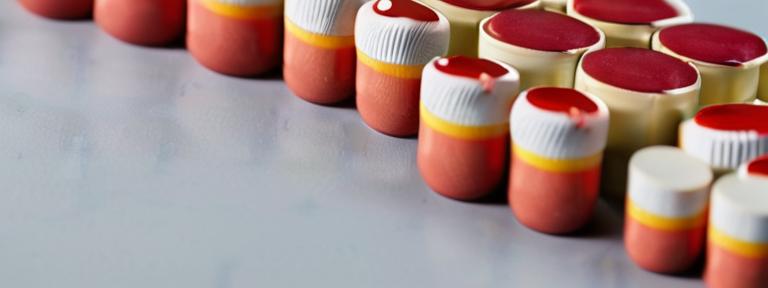 Douleurs dorsales : quand faut-il consulter un médecin