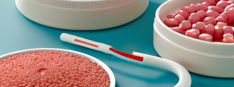 Psoriasis: tratamientos modernos y cuidados de la piel