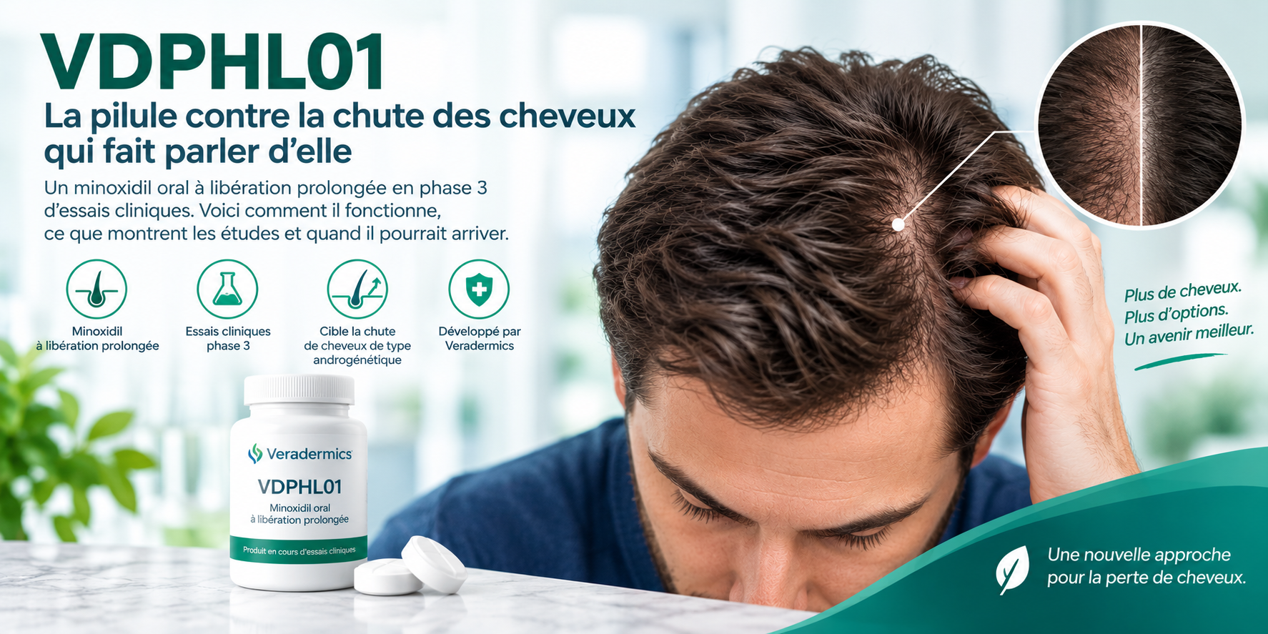 VDPHL01 : la pilule anti-chute de cheveux qui fait parler